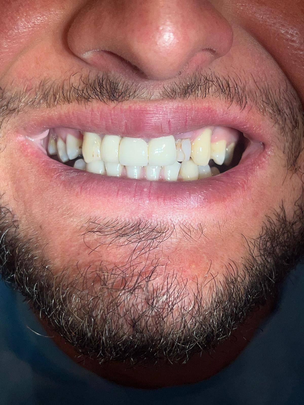 ECE Dental Patient Transformation